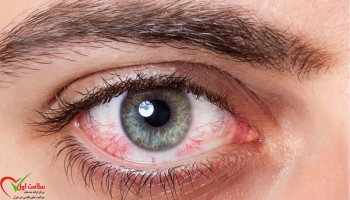 خطرناک ترین بیماری های چشم